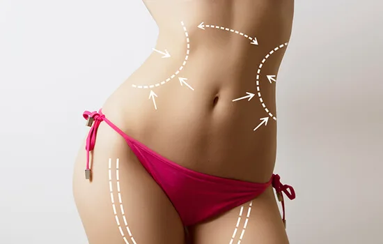 vaser-liposuction-surgery